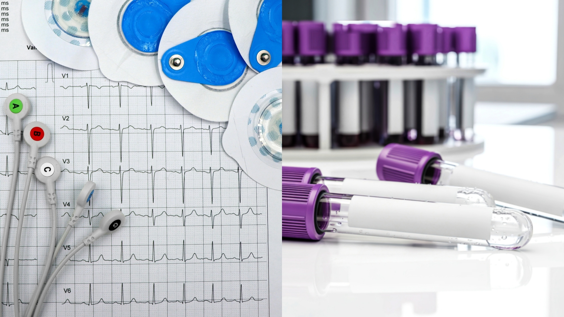 EKG and Phlebotomy Certificate Training Program | JVS of MetroWest